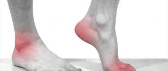 The main symptom of gout is joint pain, but it is not so much a joint disease as a metabolic disease