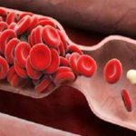 Как разжижать кровь народными средствами рекомендации врачей. Разжижение крови народными методами и средствами